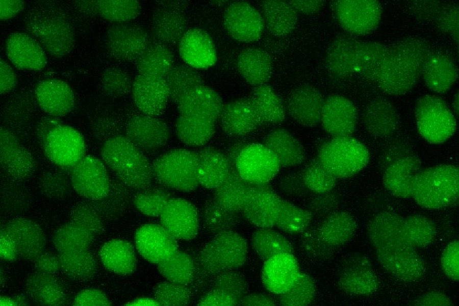 Fluorescent green proteins help visualize mRNA in a live mouse brain
