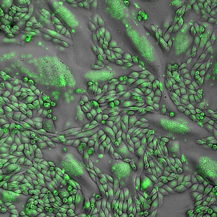 Image at the cellular level using imaging technology. Shows bright green patches against a gray background.