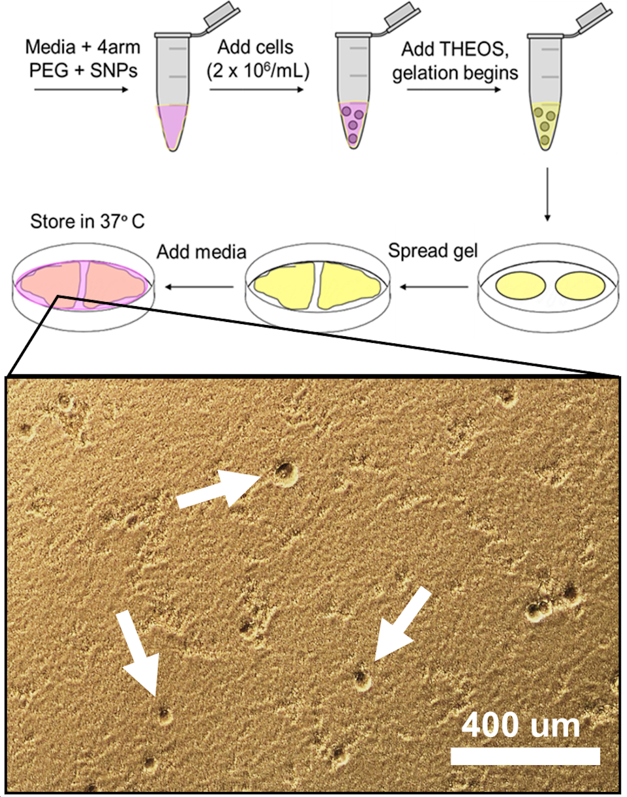 Illustration of ovarian cancer cell encapsulation