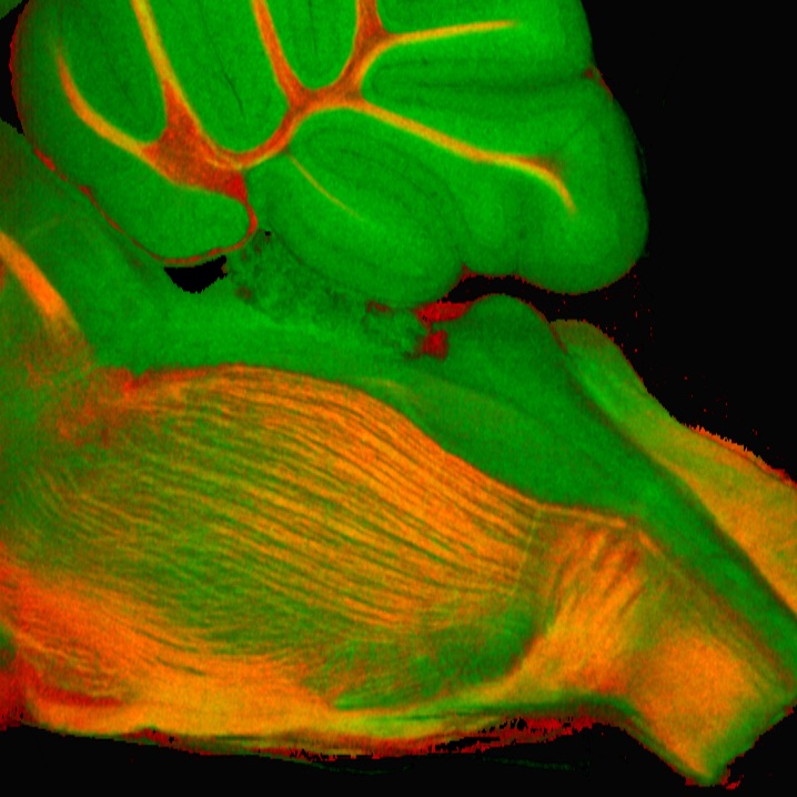 Image of the human brain using imaging technology; brain is green and red against a black background. 