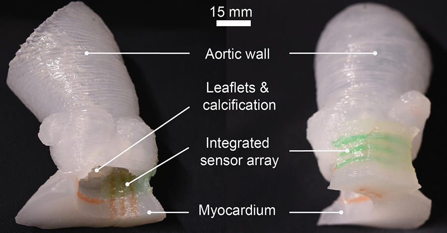 3D-printed aortic root models