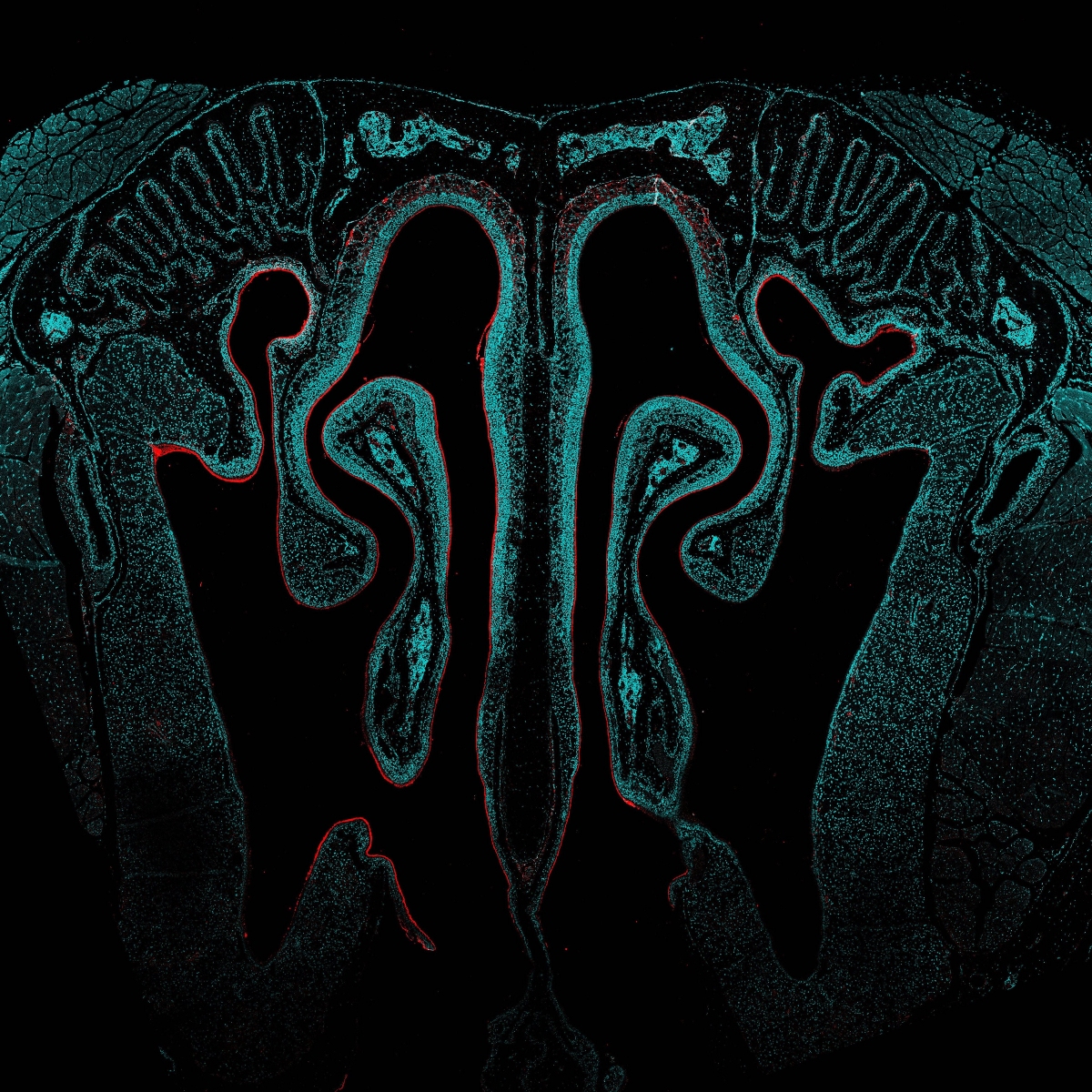 biomedical image showcasing the mucosal area.