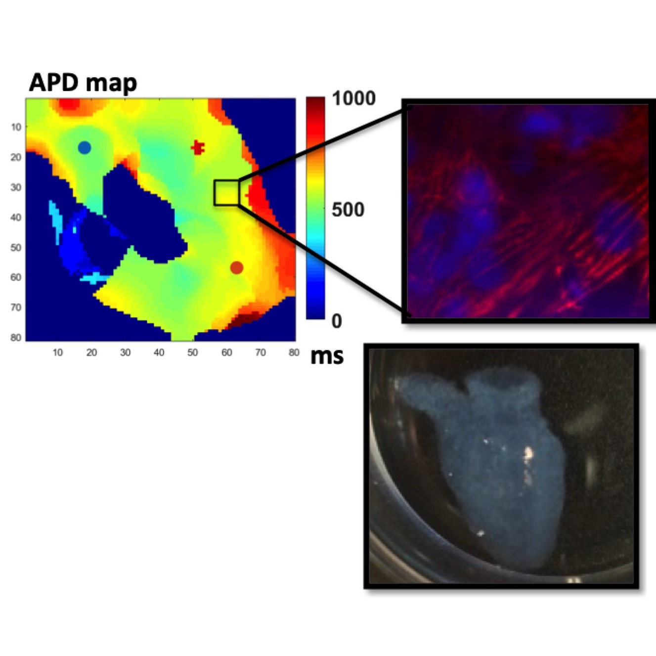 Compilation of three graphics: A graph that's an ADP map with an ms scale of 0 to 1000. A second purplish graphic taken with imaging technology shows a zoomed-in portion of the ADP map. Also an image of a 3-D printed tissue.
