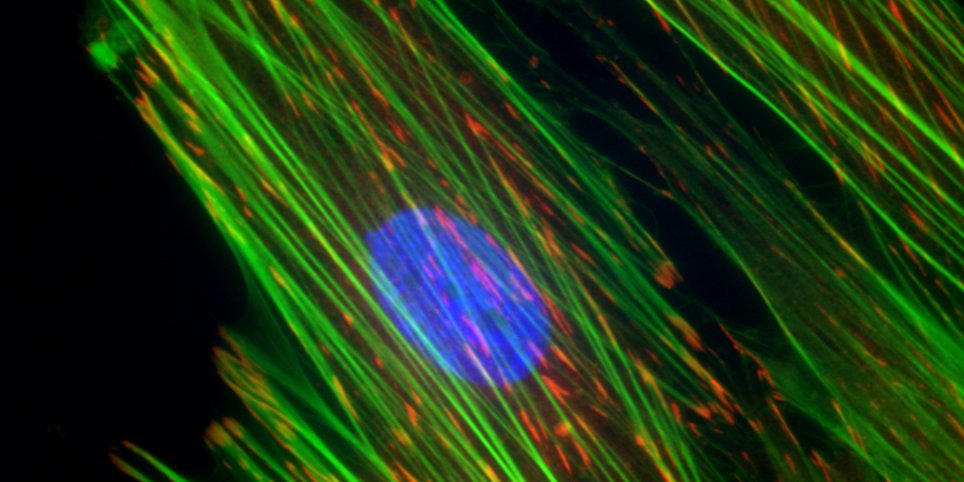 Close up of cells using imaging technology; green lines and blue circular cluster against a black background
