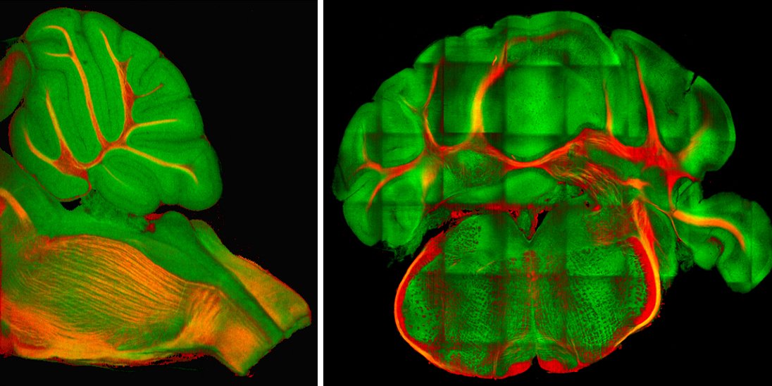 Image of human brain using imaging technology; shows green and red brain against a black background
