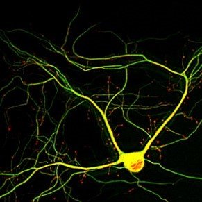 A neuron with tau mislocalization