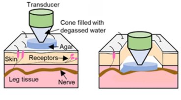 Diagram showing using ultrasound to modulate nerve activity