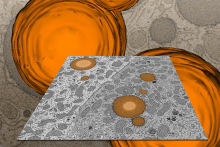 electron micrograph cells