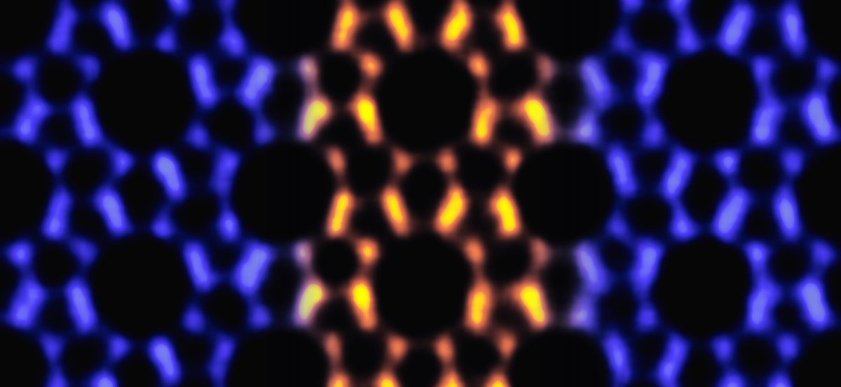 A transmission electron microscopy image 
