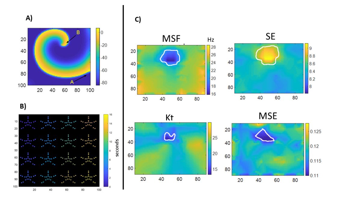 Graphs showing: A) Driver of AF: stationary rotor. B) Sequential placement of the multielectrode multispline catheters for rotor identification mimicking clinical settings. C) 2-dimentional maps demonstrating core of the rotor identification using several techniques: Kt, kurtosis; MSE, multiscale entropy; MSF, multiscale frequency; SE, Shannon entropy. 