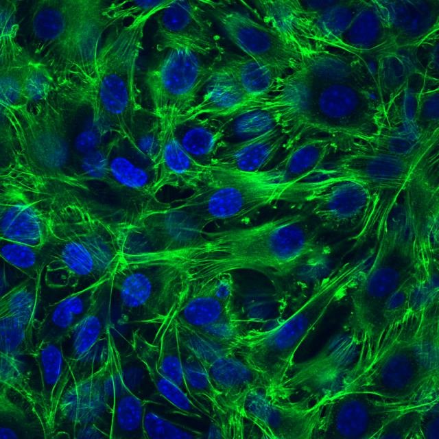 Cancer cells exhibiting normal characteristics after exposure to a photochemically activated drug