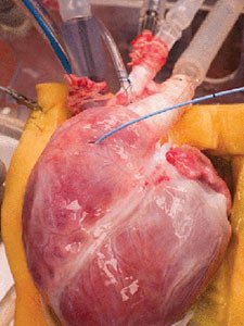 close up of human heart in a lab