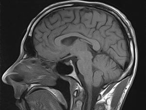 x-ray showing cross section of human brain