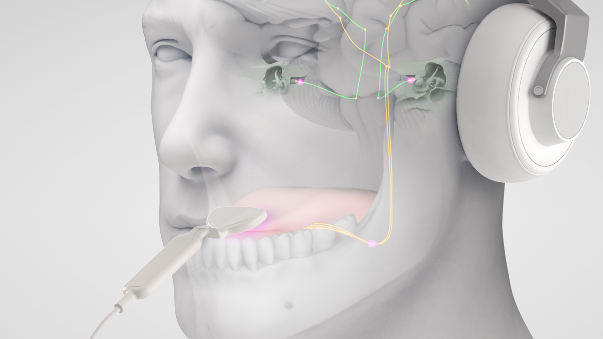 rendering of a tinnitus device