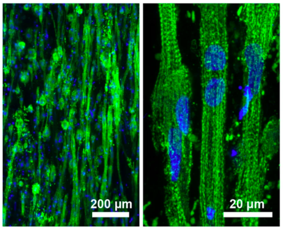 New BME study creates 3D functional skeletal muscle constructs using ...